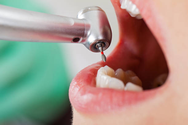 Professional Emergency Dental Service in MT